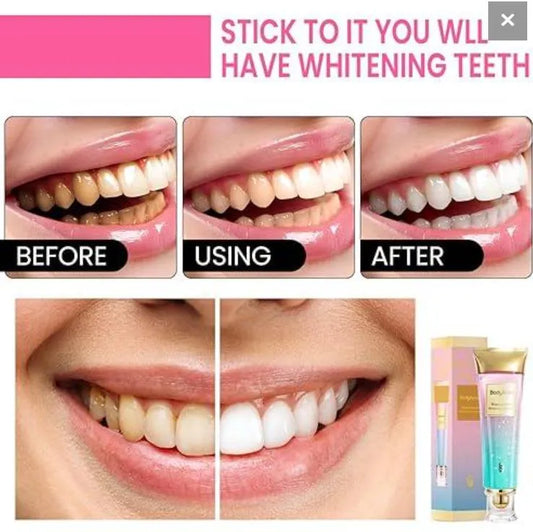 Body Accel Whitening Toothpaste Cream 50ml Smooth Packaging True Point